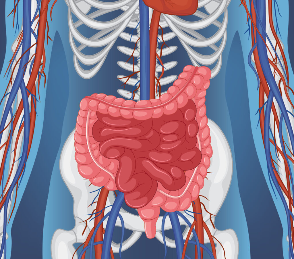 Human colon to show where colonic polyp raises 