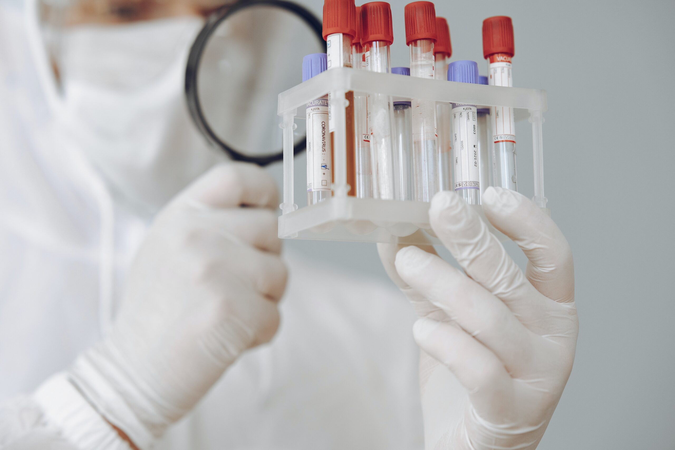 Erythrocyte Sedimentation Rate (ESR)